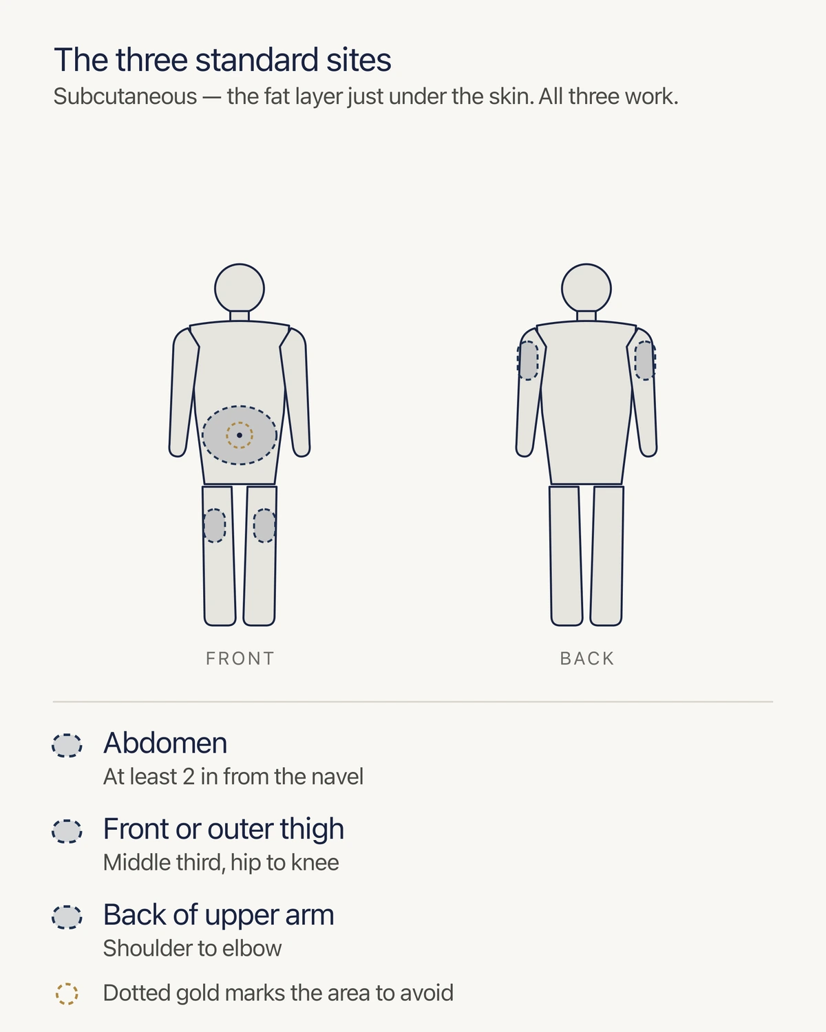 Diagram showing the three subcutaneous injection sites: abdomen, thigh, and upper arm