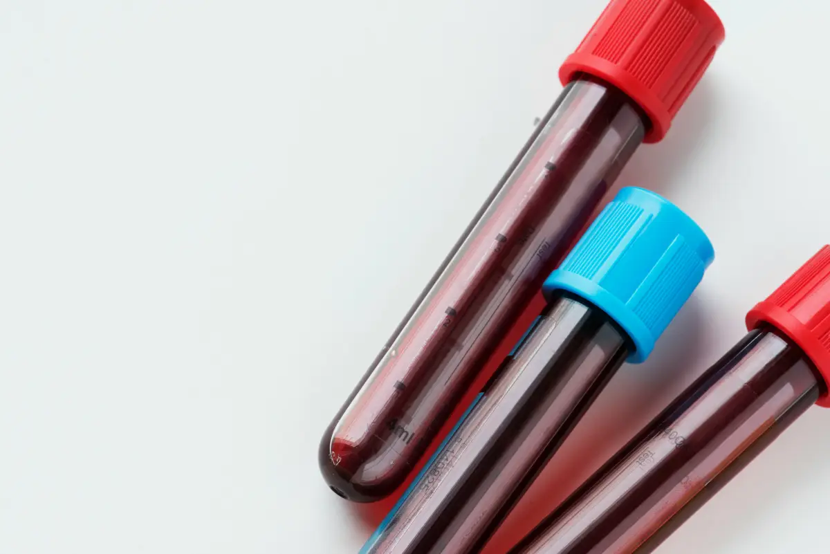 Labeled blood collection tubes at a draw site
